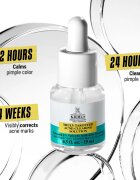 Kiehl's Dermatologist Solutions Truly Targeted Blemish-Clearing Solution sérum na aknózní pleť pro ženy 15 ml