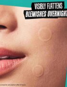 Kiehl's Truly Targeted Overnight Blemish Patch náplasti na problematickou pleť pro ženy 22 ks
