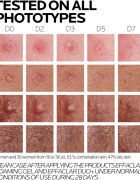 La Roche-Posay Effaclar sada pro problematickou pleť akné