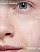 La Roche-Posay Effaclar Ultra čisticí micelární voda pro problematickou pleť akné 200 ml