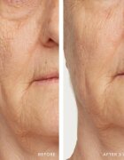 LANCER NOURISH REHYDRATION MASK hydratační a vyživující pleťová maska 50 ml