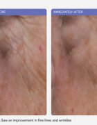 LANCER Ultra Rich Barrier Cream hydratační krém s ceramidy pro posílení kožní bariéry 50 ml