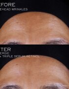 Lancôme Rénergie CRX Triple Serum Retinol pleťové sérum 50 ml