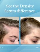 Living Proof Scalp Care sérum pro obnovení hustoty vlasů 50 ml