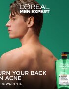 L’Oréal Paris Men Expert Derma Control sprchový gel pro citlivou a problematickou pokožku 1000 ml