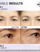 L’Oréal Paris Revitalift Filler sada pro péči o pleť na obličej a oční okolí