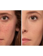 L’Oréal Paris True Match The One tekutý korektor odstín 1.R/C Rose Ivory 6.8 ml