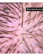 L’Oréal Professionnel Serie Expert Scalp Advanced vlasová péče na vlasy a vlasovou pokožku 200 ml