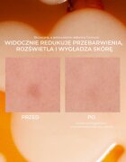 Lumene Nordic-C [VALO] Dark Spot Serum rozjasňující sérum s vitaminem C proti pigmentovým skvrnám 30 ml