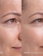 Mádara MÁDARA Kojic Alternative Pigment Serum sérum proti pigmentovým skvrnám 30 ml