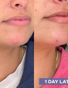 Mario Badescu Repairing Facial Spray With Hypochlorous Acid obnovující pleťový sprej pro zklidnění pleti 118 ml
