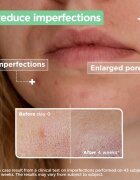 MIXA Anti-Imperfection sérum pro problematickou pleť akné 30 ml