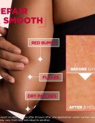 MIXA Urea Cica Repair+ regenerační tělový krém pro velmi suchou pokožku 150 ml