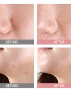 Mizon Good Bye Blemish Pink Spot lokální sérum s pudrem proti akné 19 ml