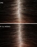 Moroccanoil Scalp Conditioner zklidňující kondicionér pro mastnou pokožku hlavy proti lupům 70 ml