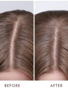 Moroccanoil Scalp Dry Scalp Treatment hloubkově vyživující kúra pro suchou pokožku 45 ml
