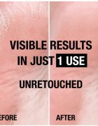 Neutrogena Norská receptura® výživný krém na chodidla 100 ml