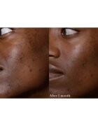 Omorovicza Elixir elixír pro výživu a revitalizaci pleti 30 ml