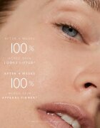 Omorovicza Queen Serum omlazující pleťové sérum 30 ml