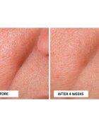 Perricone MD Cold Plasma Plus+ Advanced Serum vyživující sérum na obličej 30 ml