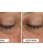 Perricone MD Cold Plasma Plus+ Eye Cream vyživující oční krém proti otokům a tmavým kruhům 15 ml