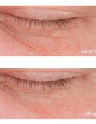 Perricone MD Cold Plasma Plus+ Eye Cream vyživující oční krém proti otokům a tmavým kruhům 15 ml