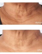 Perricone MD Cold Plasma Plus+ Sub-D/Neck zpevňující krém na krk a dekolt 59 ml
