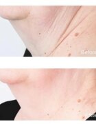Perricone MD Cold Plasma Plus+ Sub-D/Neck zpevňující krém na krk a dekolt 59 ml