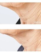 Perricone MD Cold Plasma Plus+ Sub-D/Neck zpevňující krém na krk a dekolt 59 ml