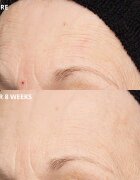 Perricone MD Cold Plasma Plus+ The Intensive Hydrating Complex intenzivní hydratační krém 30 ml