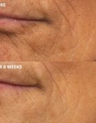 Perricone MD Cold Plasma Plus+ The Intensive Hydrating Complex intenzivní hydratační krém 30 ml