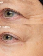 Perricone MD Cold Plasma Plus+ The Intensive Hydrating Complex intenzivní hydratační krém 30 ml