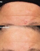 Perricone MD Cold Plasma Plus+ The Intensive Hydrating Complex intenzivní hydratační krém 30 ml
