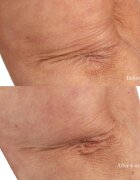 Perricone MD Essential Fx Acyl-Glutathione Chia Body Oil suchý tělový olej 118 ml