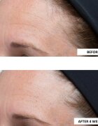 Perricone MD High Potency Classics Intensive Moisturizer intenzivní hydratační krém s kyselinou hyaluronovou 30 ml