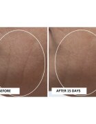 Perricone MD High Potency Classics Intensive Moisturizer intenzivní hydratační krém s kyselinou hyaluronovou 30 ml