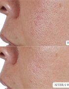 Perricone MD High Potency Face Finishing & Firming Toner zpevňující tonikum 118 ml