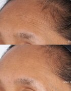 Perricone MD High Potency Intensive Hydrating Mask intenzivní hydratační pleťová maska s kyselinou hyaluronovou 59 ml