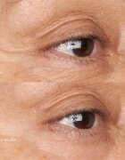 Perricone MD Hypoallergenic Clean Correction Eye Cream hydratační a rozjasňující péče na oční víčka a kruhy pod očima 15 ml