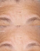 Perricone MD Hypoallergenic Clean Correction Moisturizer hydratační a vyživující krém 59 ml