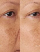 Perricone MD Hypoallergenic Clean Correction Moisturizer hydratační a vyživující krém 59 ml