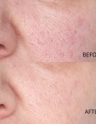 Perricone MD Hypoallergenic Clean Correction Smoothing Restorative Serum vyhlazující sérum pro hydrataci a rozjasnění pleti 59 ml