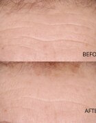 Perricone MD Hypoallergenic Clean Correction Smoothing Restorative Serum vyhlazující sérum pro hydrataci a rozjasnění pleti 59 ml