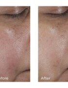 Perricone MD No:Rinse Pore Minimizing Toner intenzivní tonikum pro vyhlazení pleti a minimalizaci pórů 118 ml