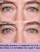 Peter Thomas Roth Instant FIRMx Collagen Infusion Tighteneing Eye Patches zpevňující gelové polštářky pod oči 1 ks