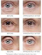 Peter Thomas Roth Instant FIRMx Eye oční krém pro omlazení pleti 15 ml