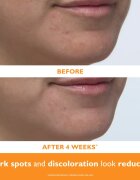Peter Thomas Roth Potent-C™ Power Serum rozjasňující sérum s vitaminem C proti stárnutí pleti 30 ml