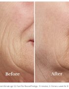 Silk'n FaceTite Essential přístroj pro revitalizaci a omlazení pleti 1 ks