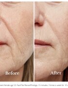 Silk'n FaceTite Essential přístroj pro revitalizaci a omlazení pleti 1 ks