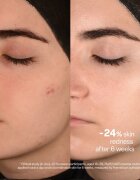 SKINSOO PurifyCell Exosome Toner zklidňující tonikum na regulaci kožního mazu 200 ml
